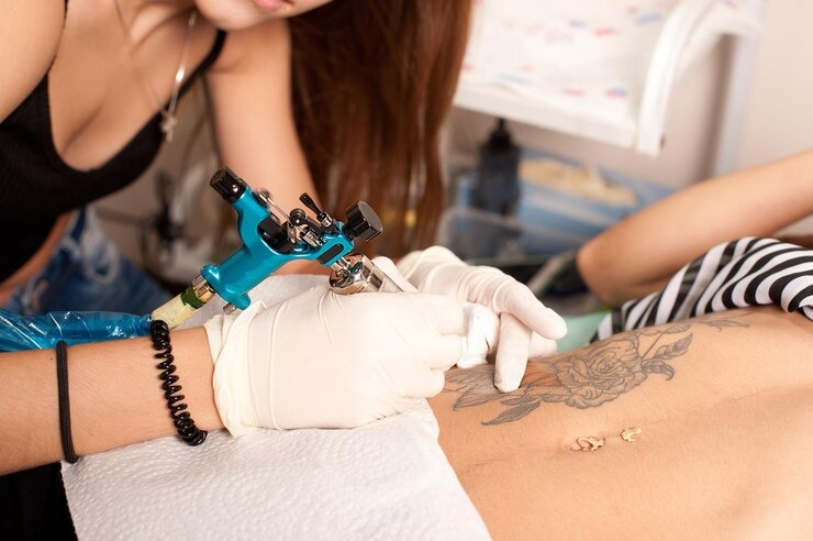 Body Tattoo Removal