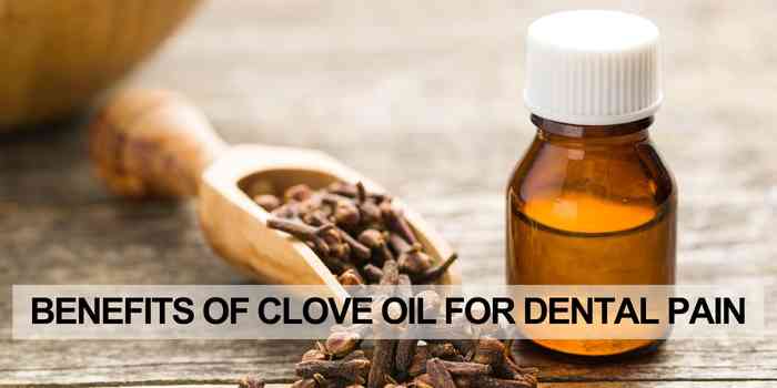 clove oil for dental pain