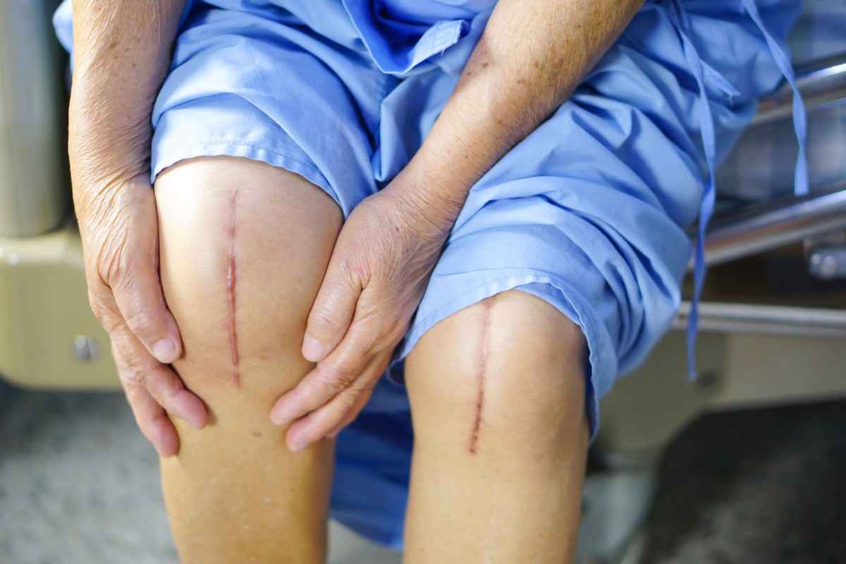 knee_replacement