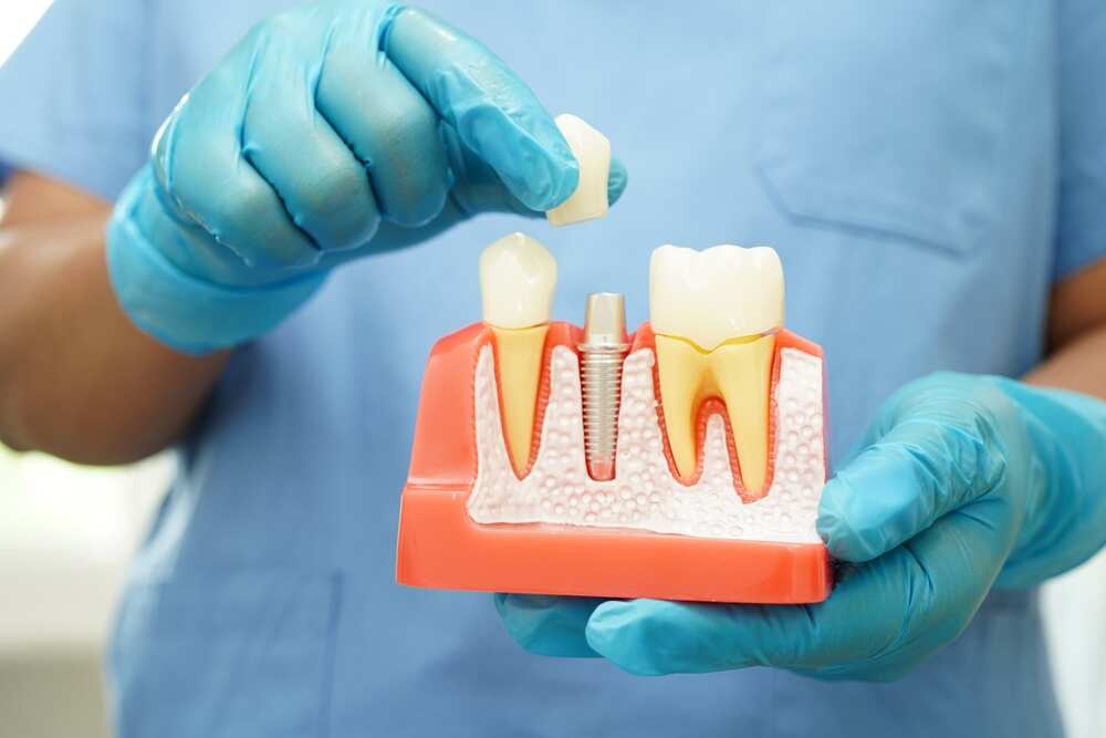 Dental Crowns in Arlington