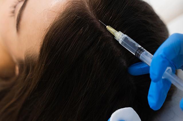 The Qr678 The Best Hair Loss Treatment