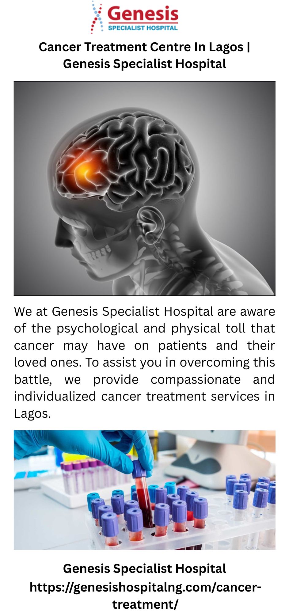Cancer Treatment Centre In Lagos Genesis Specialist Hospital
