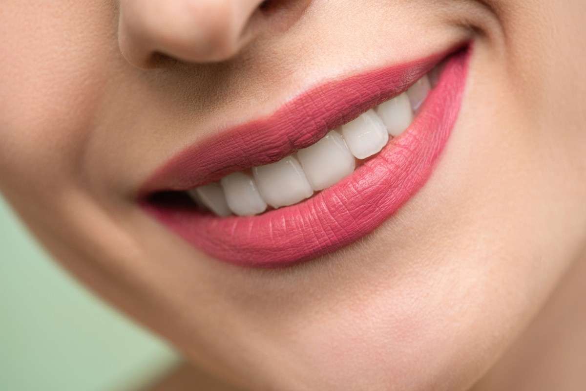 When to Consider Professional Teeth Whitening