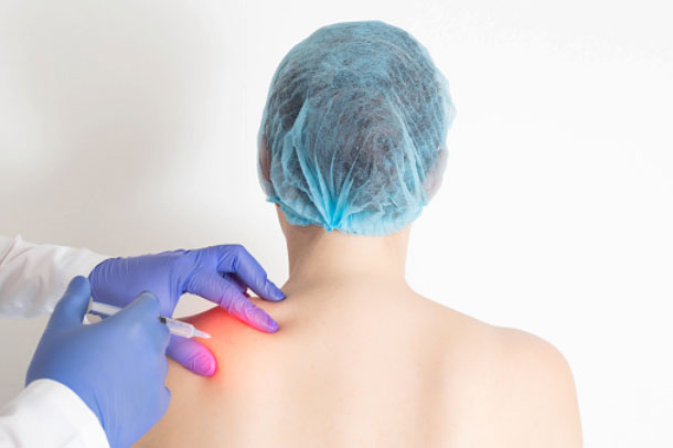 Trigger Point Injections for Sports Injuries
