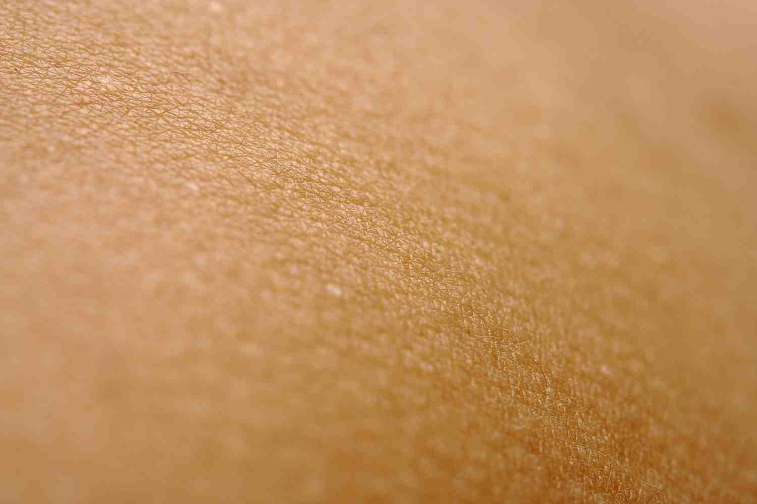 Chilblain Lupus: Symptoms, Causes & Management 