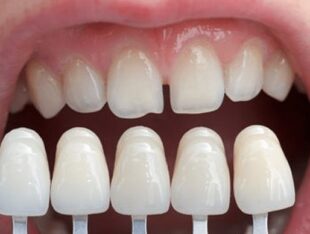 Cosmetic Dentistry Apple Tree Dental