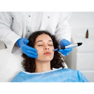 Injectable Facial Fillers in Chandler