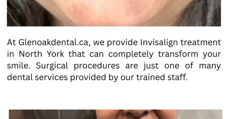 Pain free Dentist South London Appletreedental.ca 5