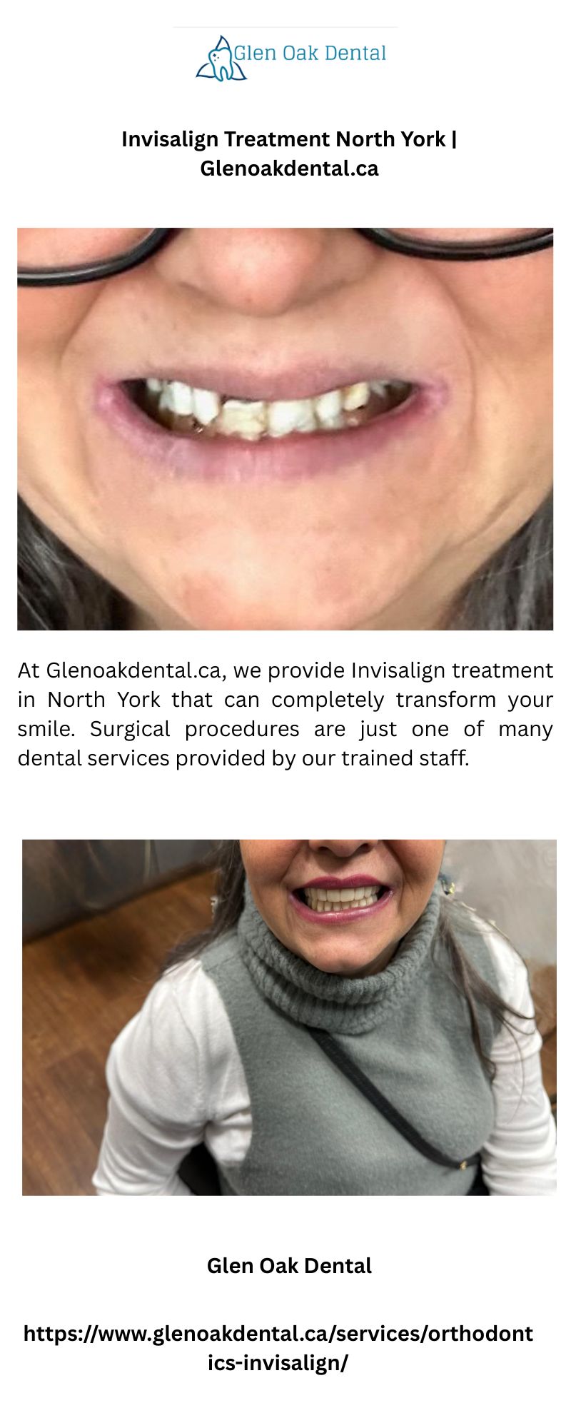 Invisalign Treatment North York | Glenoakdental.ca 1 Pain free Dentist South London Appletreedental.ca 5