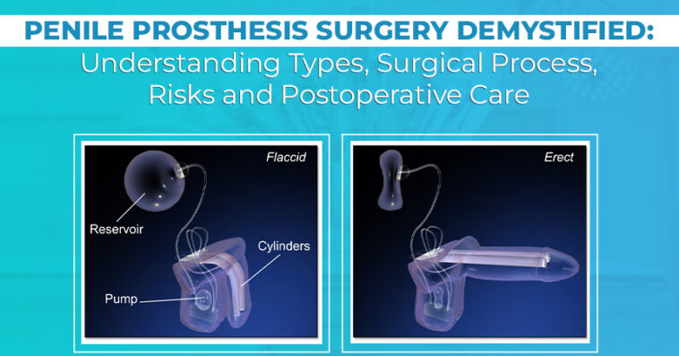 Penile Prosthesis Surgery