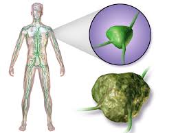 What Is Lymphoma? Types & Symptoms to Know 