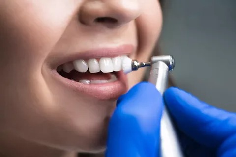 Trusted Preventive Dental Care in NYC