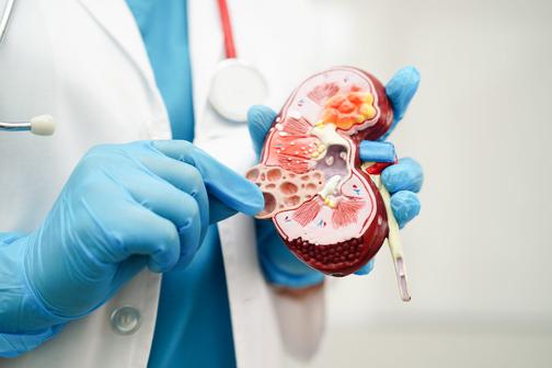 Need a Good Urologist? Here’s a Trusted Clinic in Greater Noida 1 urology image