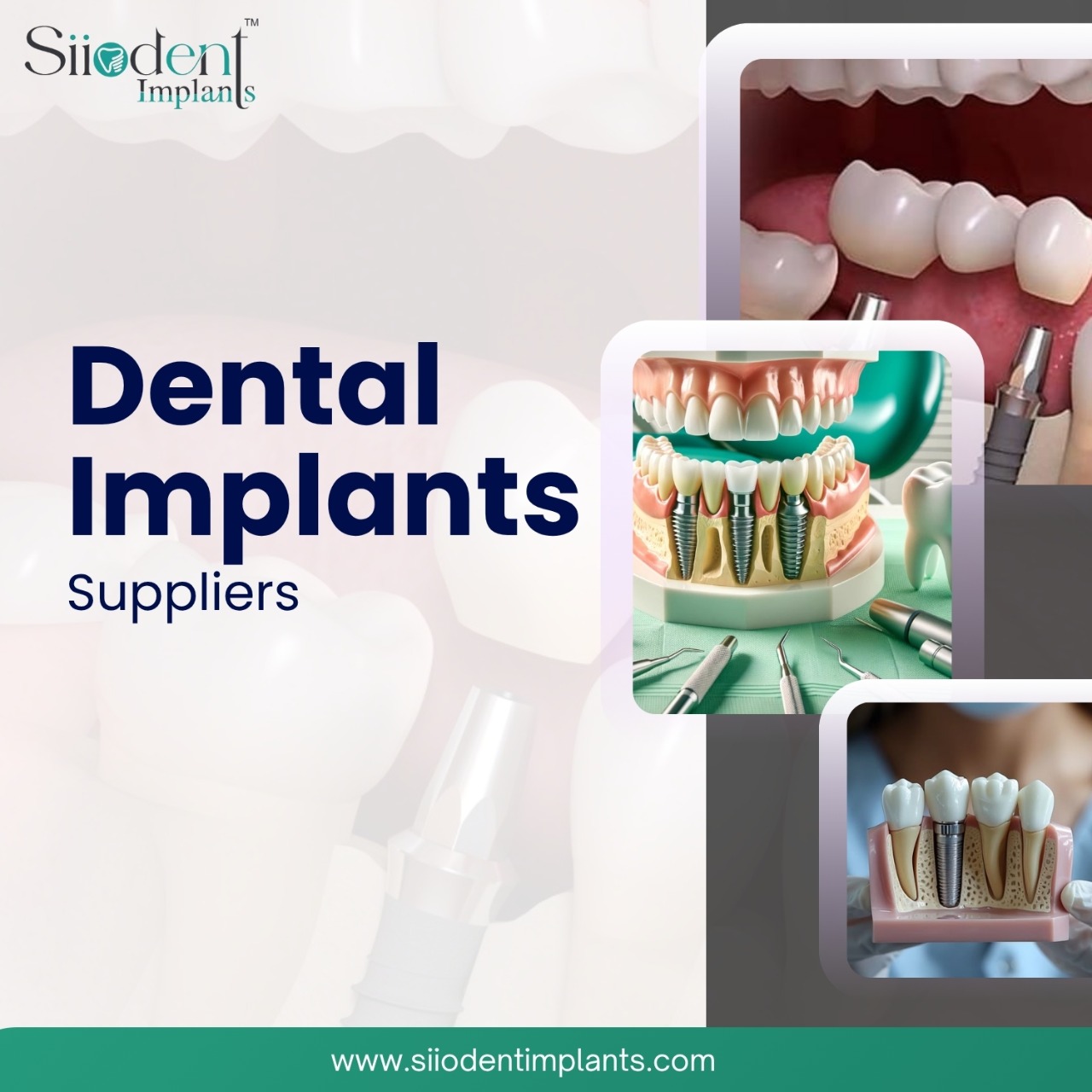 Leading-Edge Dental Implant Manufacturers in Mexico 1 16 1