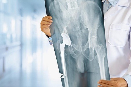 Meet the Best Orthopedic Doctor in Nagpur