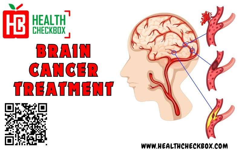 Top 5 Cities in India for Top Brain Cancer Treatment