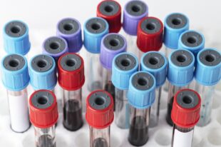 blood samples test tube rack