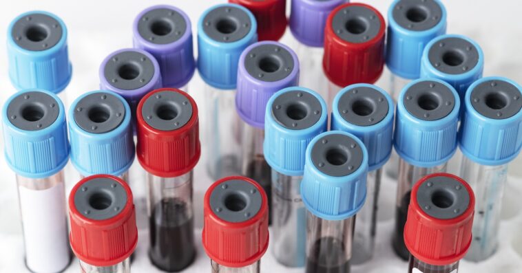 blood samples test tube rack