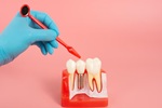 Dental Implant: Designed to Look Your Natural Teeth
