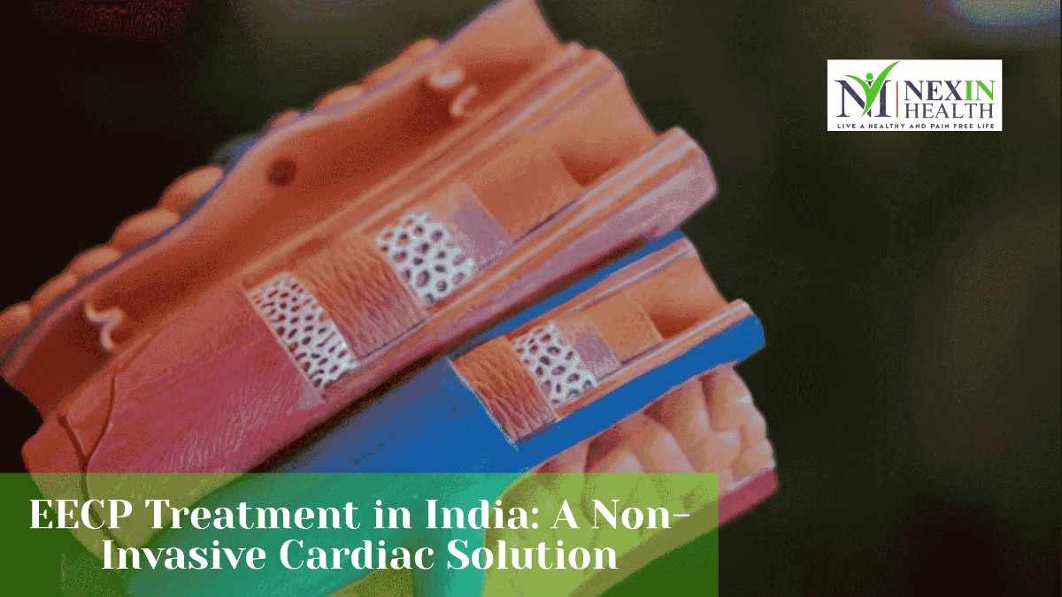 eecp treatment in india 111