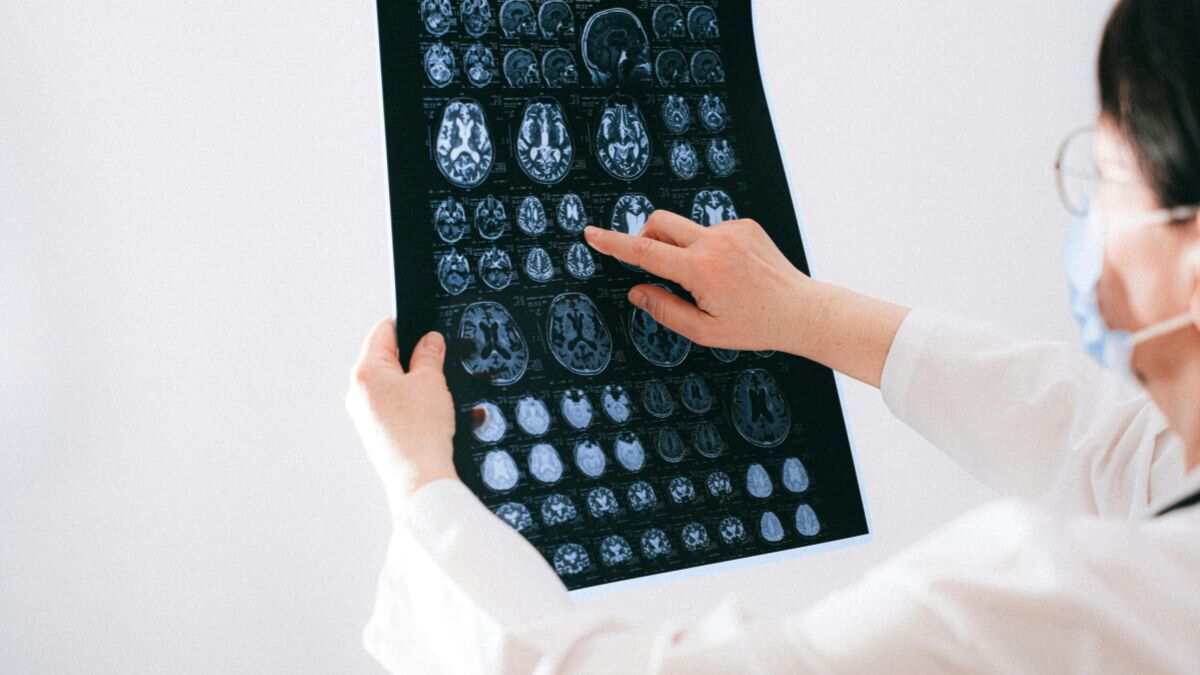 Cranial MRI: Purpose, Procedure, Cost and MRI Center