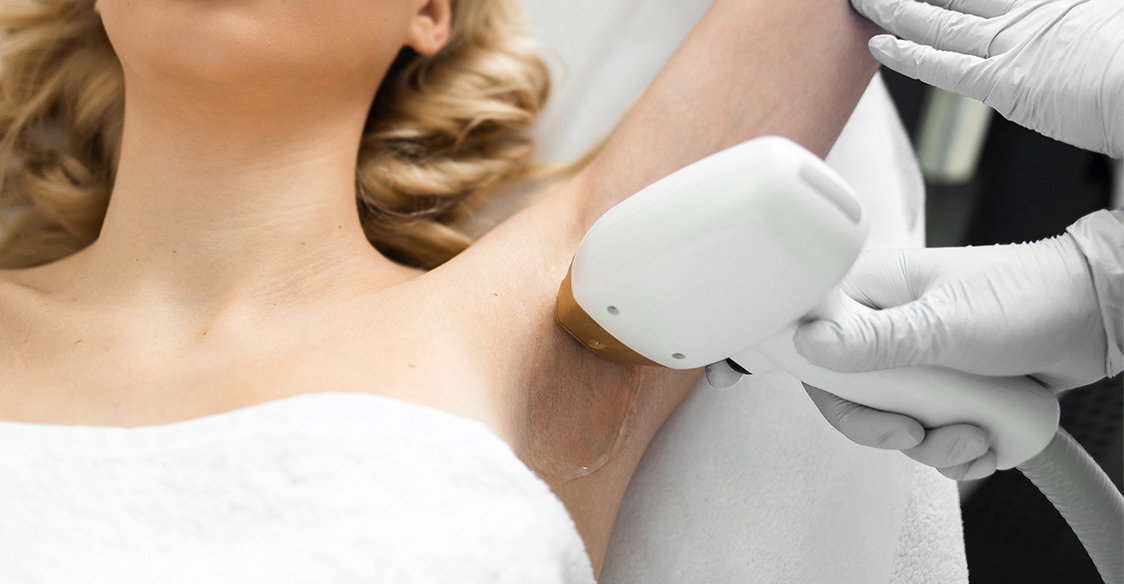 laser hair removal