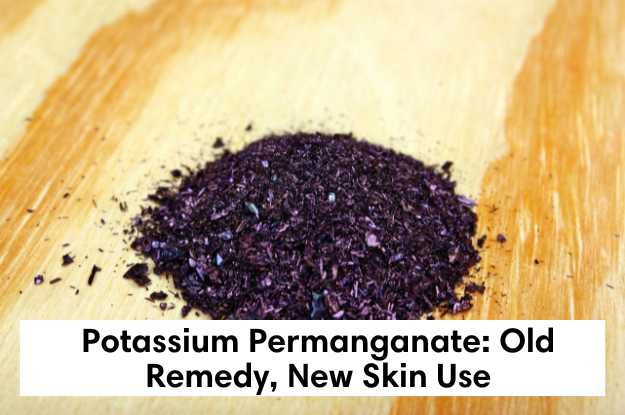 Potassium Permanganate: Old Remedy, New Skin Use