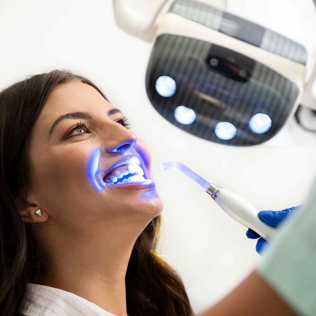 Maintaining Your Teeth Whitening Results in Arlington