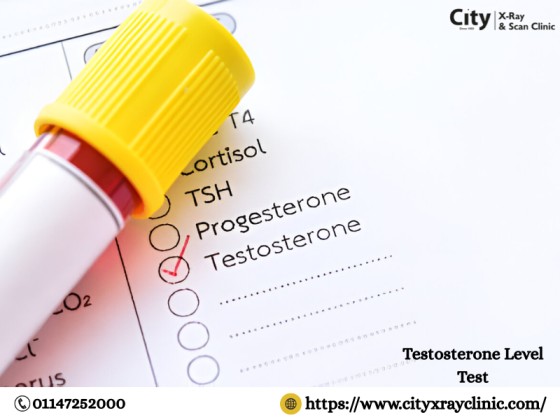 Guide to Testosterone Level Test Price & Factors