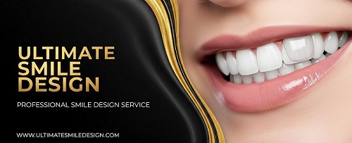 Smile Design Crafting Your Perfect, Natural Smile