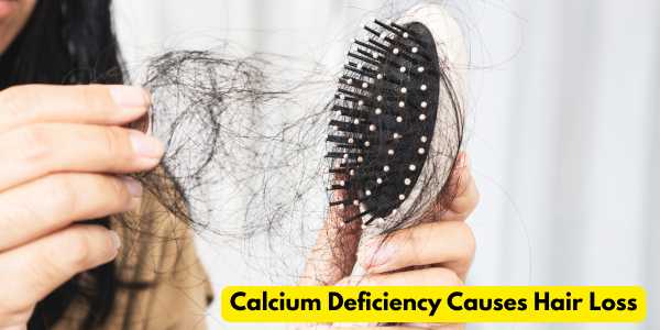Calcium Deficiency Causes Hair Loss – Expert Insights