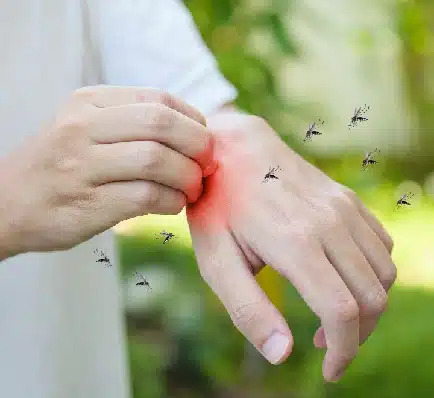 Trusty Safe Methods to Keep Mosquitoes Away