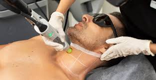 Skin Pen Treatment: The Modern Solution