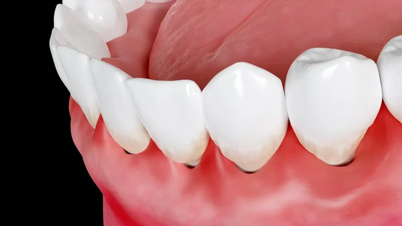 Simple Tips for Smoother Healing After a Root Canal