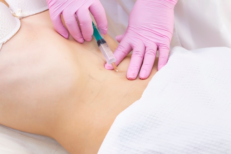 Natural Body Contouring with Body Fillers in Islamabad