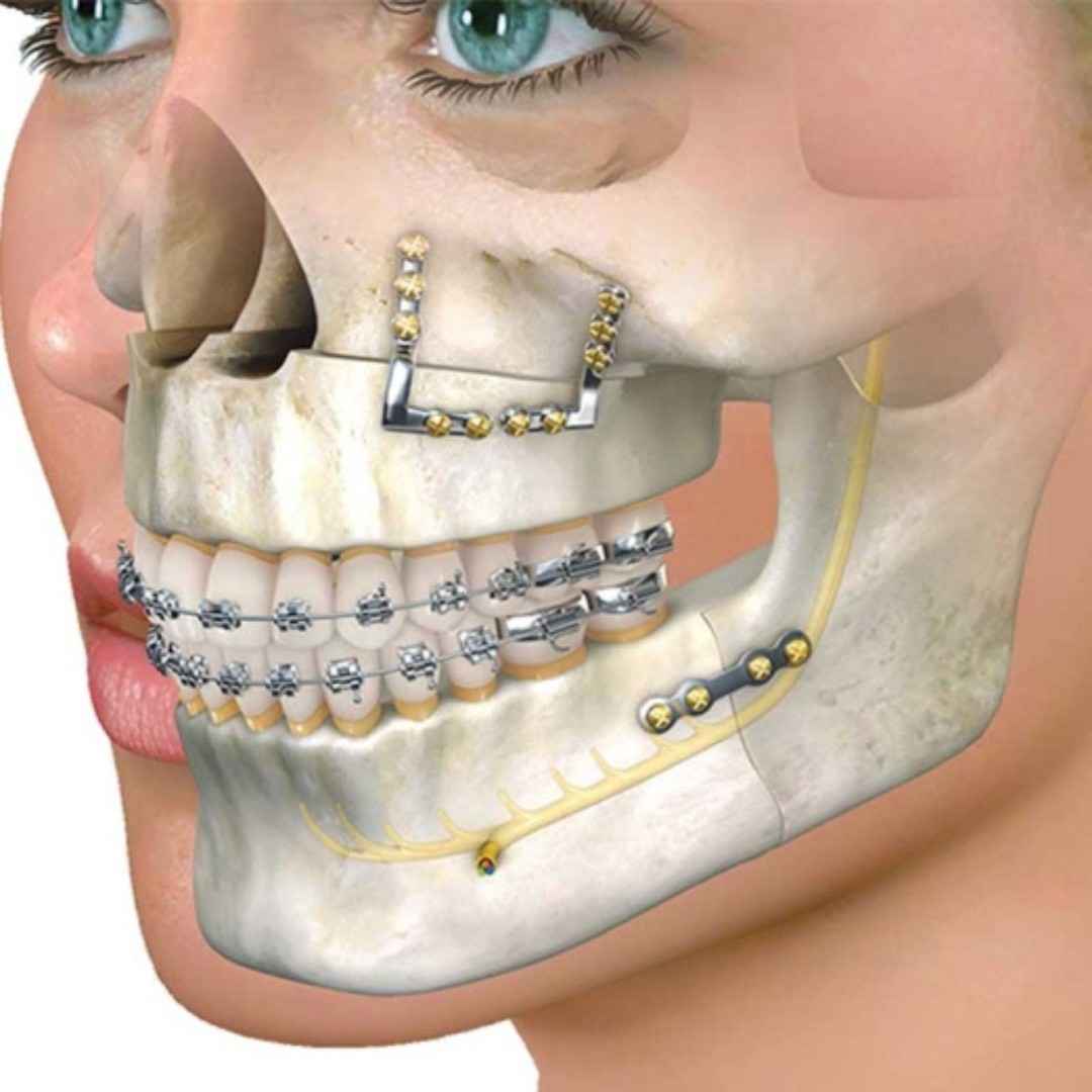 Maxillofacial Surger