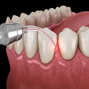 Practical Periodontal Care: Steps That Work