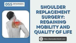 Classifieds 4 Shoulder replacement