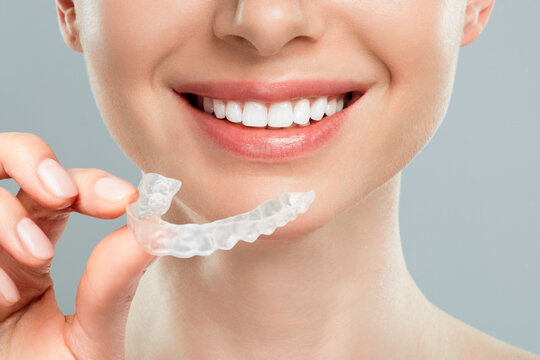 Are Aligners Worth It? The Truth in Koparkhairane