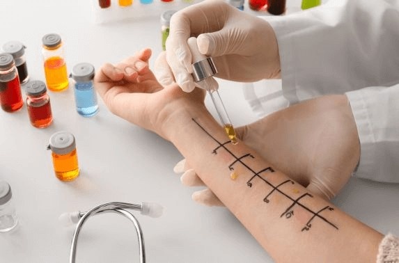 allergy testing in duba