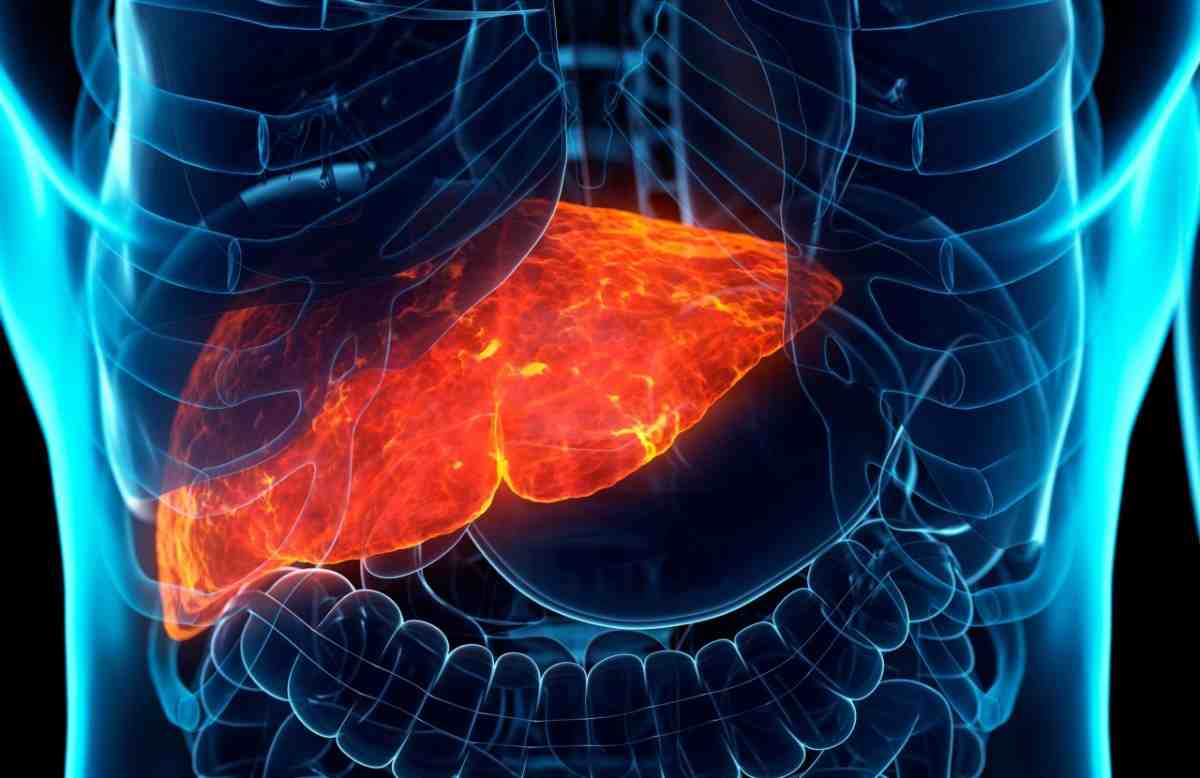 diseased liver G 1190667811 scaled 1 1