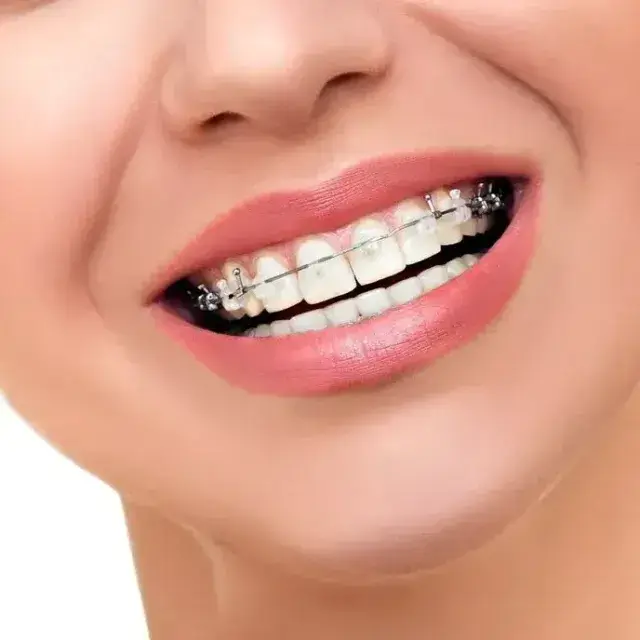 West Orange NJ Affordable Orthodontist Options for You
