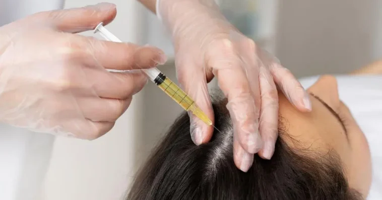 prp for hair restoration