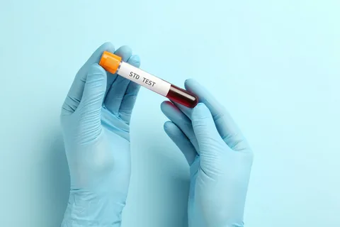 How to Prevent STDs: Simple Tips to Stay Safe